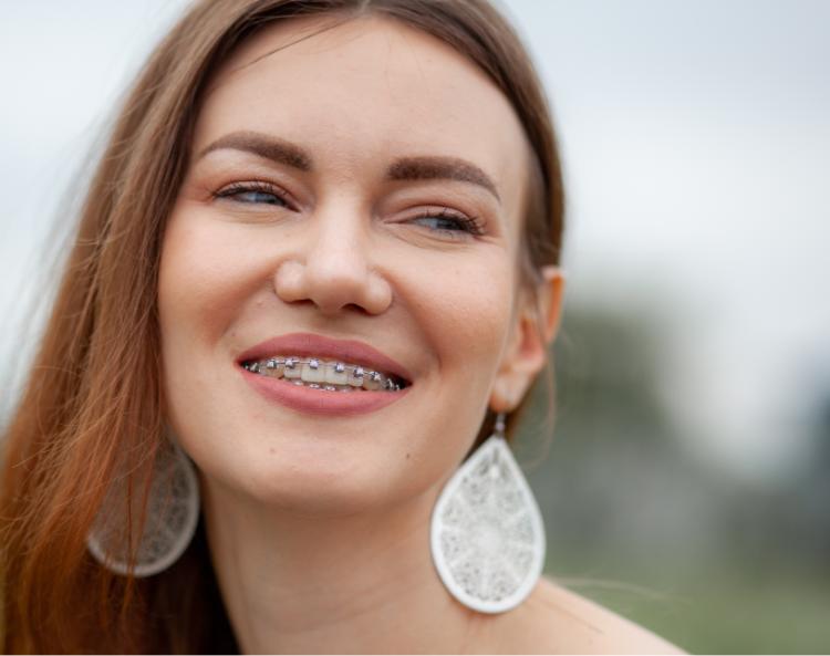 Adult woman smiling with clear aligners