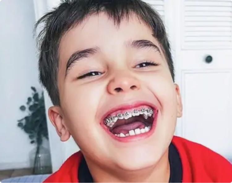 Smiling child with colorful braces