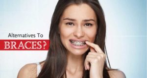 Alternatives to braces