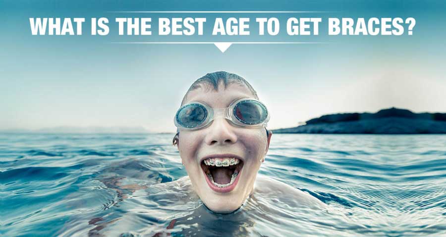 What is the best age to get braces?