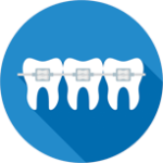 the best braces for kids