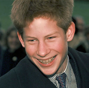 prince harry with braces