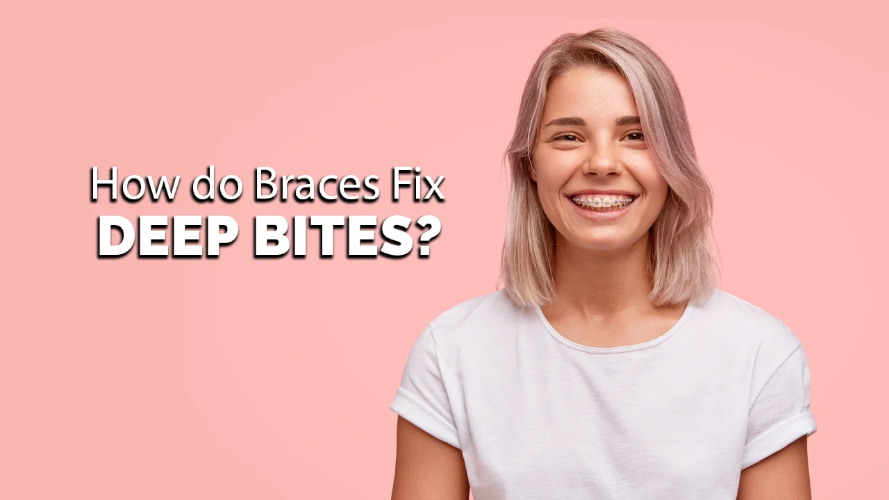 how do braces fix deep bites
