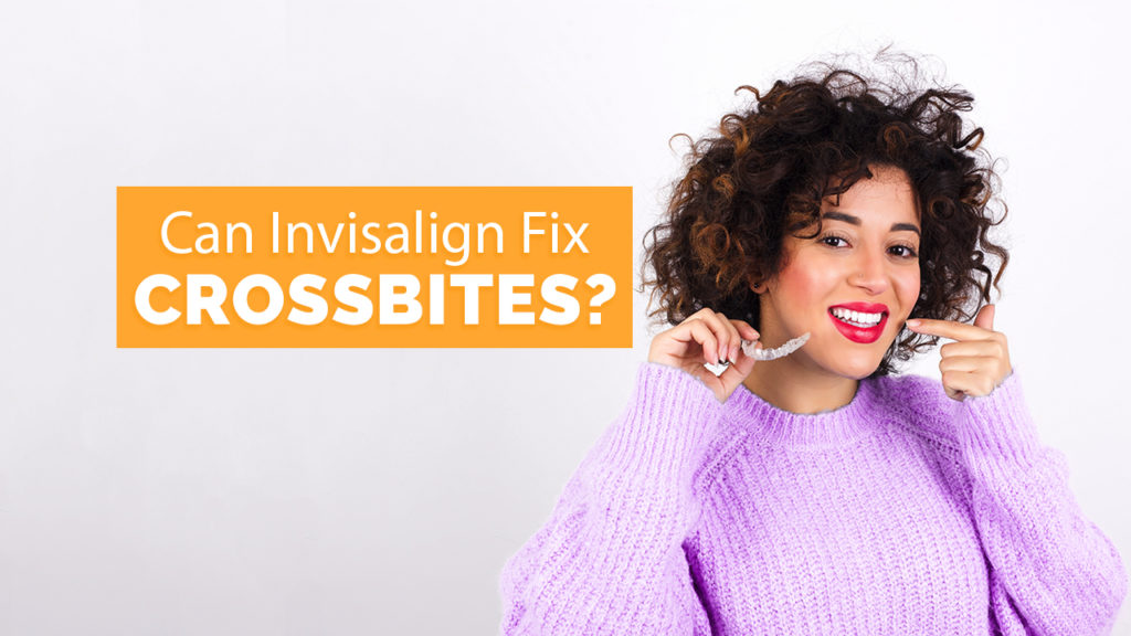 Can Invisalign fix crossbites