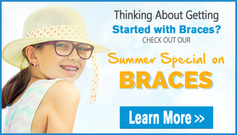 summer braces special