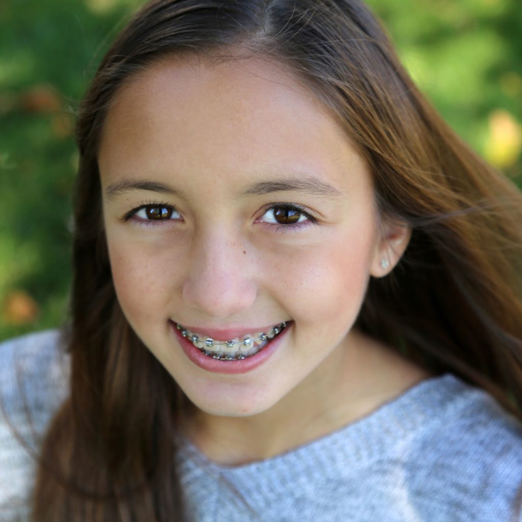braces with baby teeth