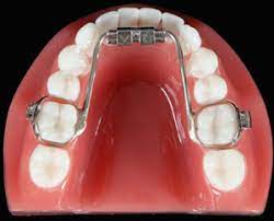 lower expander