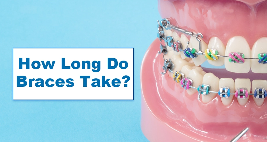 How Much Do Braces Cost? - Embrace Family