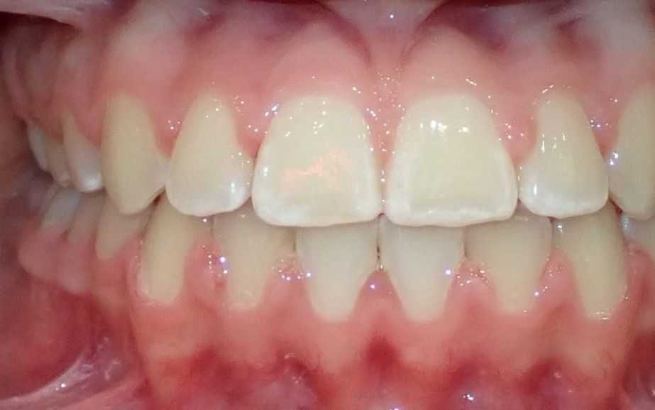 After