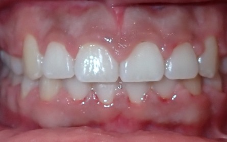 After