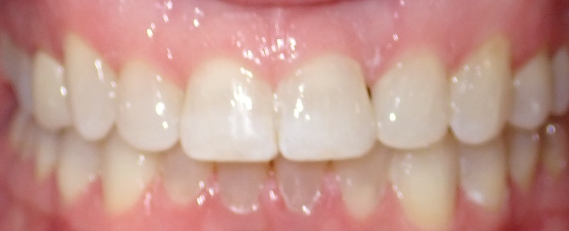 After