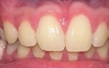 Before