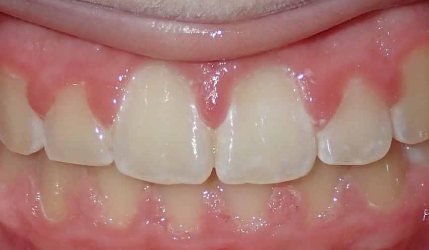 After