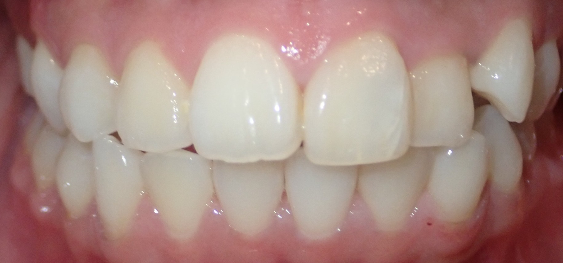 Before