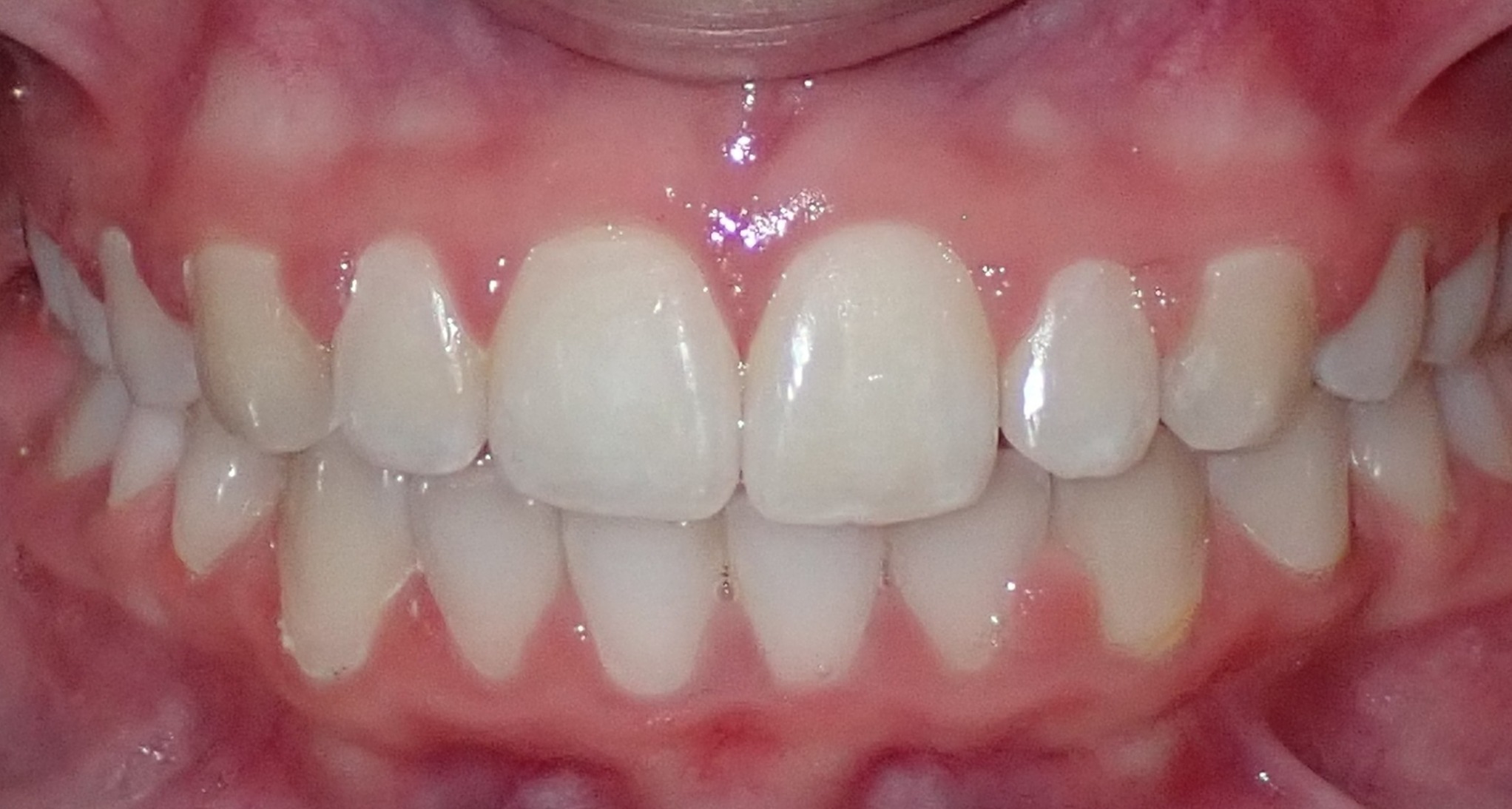 After
