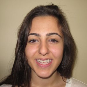 open bite before braces open bite before braces