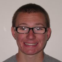 mild deep bite after braces mild deep bite after braces
