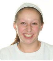 open bite after braces open bite after braces